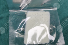 生物补片增粗手术后遗症有哪些？这些真实情况得提前搞清楚