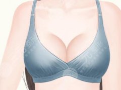 复合隆胸是假体与脂肪一起植入吗？看看项目原理|适合人群揭晓