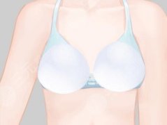 闪耀假体隆胸好吗？这些实在事儿得弄明白_别花冤枉钱