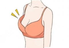 长沙隆胸医生深扒！肖征刚、文婷这些“胸科大佬”值不值得冲？