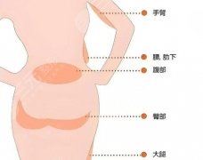 做蜜桃臀建议用脂肪填充吗？内行人给你扒明白