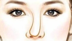 鼻翼缩小手术大概费用？内行人曝3大花钱点，附各城市报价表