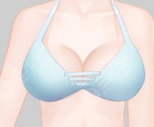 脂肪丰胸效果可以维持多长时间？内行人偷偷说的维持关键都在这