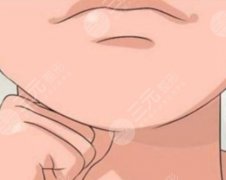 下巴后缩做正颌手术还是垫下巴？项目咋选|看完这篇不踩坑