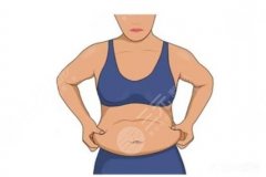 纠结抽脂选哪种？超声波vs普通吸脂，看完这篇不用问医生