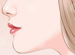 鼻基底凹陷用什么填充最好？3种填充方式实测对比|看完再也不踩坑