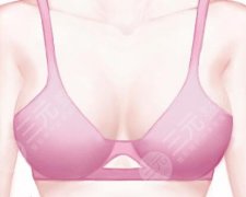 包膜挛缩一般多久出现？这些阶段要盯紧