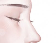 韩国韩式生科硅胶怎么样？内附医生实测数据|赶紧看吧