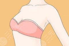 乳头漂红恢复需要多久？过来人唠这些小事比时间本身更关键