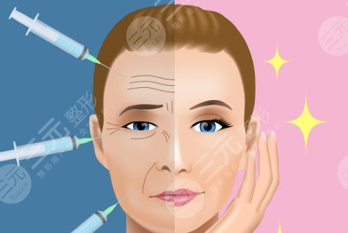 注射玻尿酸