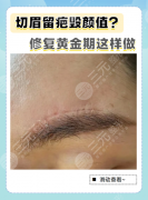 切眉的疤痕能去除吗?内行人实测:修复方案+案例+价格全公开 切眉的疤痕能去除吗?内行人实测:修复方案+案例+价格全公开