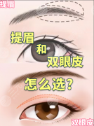 切眉和双眼皮哪个恢复快?数据说话,不同术式对应不同周期 切眉和双眼皮哪个恢复快?数据说话,不同术式对应不同周期