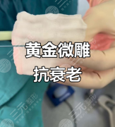 面部黄金微雕多少钱?3类常见部位价格+疗程表(附数据) 面部黄金微雕多少钱?3类常见部位价格+疗程表(附数据)