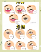 做下睑下至可以一统去眼袋吗?内行人拆穿误区:3类眼袋要对症下“刀” 做下睑下至可以一统去眼袋吗?内行人拆穿误区:3类眼袋要对症下“刀”