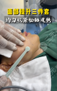脸部钻石金雕要肿胀多久?10天快速消肿,1个月逆袭小V脸 脸部钻石金雕要肿胀多久?10天快速消肿,1个月逆袭小V脸
