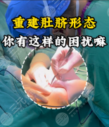 肚脐整形有副作用吗?2025真实副作用清单+避坑指南,看完再决定 肚脐整形有副作用吗?2025真实副作用清单+避坑指南,看完再决定