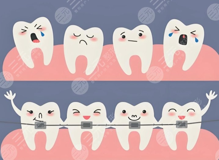 牙齿矫正