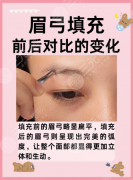 眉弓填充前后对比照片大揭秘!2025骨相抗衰神技,扁平脸秒变立体混血感 眉弓填充前后对比照片大揭秘!2025骨相抗衰神技,扁平脸秒变立体混血感