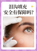 玻尿酸填充泪沟有副作用吗?最常见的“短期困扰”,3-7天可缓解 玻尿酸填充泪沟有副作用吗?最常见的“短期困扰”,3-7天可缓解
