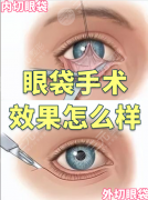 大连医大一院去眼袋怎么样?“核心优势”数据说话 大连医大一院去眼袋怎么样?“核心优势”数据说话