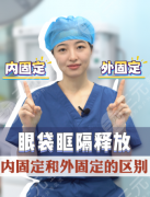 眶隔释放内固定和外固定哪个好？没有最好，只有最适配