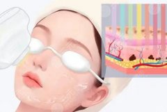 激光除皱有后遗症吗？全面解析与实用指南