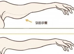 手臂抽脂手术一次大概多少钱？从价格构成到术后恢复的完整指南