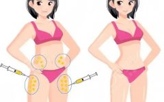 大腿抽脂和小腿抽脂可以一起做吗？一次搞清联合抽脂的价、人、风险