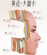 英伦大提升效果好吗？术后15天真实记录：我的脸发生了什么变化