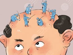 齐鲁医院植发哪个医生好？植发“真神”医生大起底：刘培、李冬梅、张凯谁更