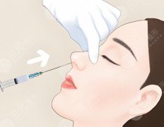 大同第三人民医院做鼻子手术好吗?价格、技术、恢复一条龙,三院鼻子攻略在此 大同第三人民医院做鼻子手术好吗?价格、技术、恢复一条龙,三院鼻子攻略在此