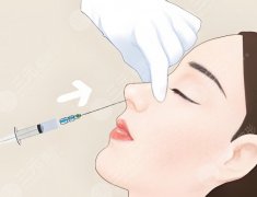 做自体脂肪隆鼻多久消肿？怕肿星人看过来，脂肪隆鼻恢复日历来了
