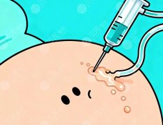 南通第一人民医院抽脂怎么样?不同部位、不同体脂,后都瘦了多少? 南通第一人民医院抽脂怎么样?不同部位、不同体脂,后都瘦了多少?