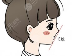 下巴后缩正颌手术怎么做的？从面诊到拆板：下巴后缩手术180天实录