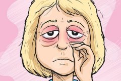 眼袋消除的最佳方法？深度解析：不同年龄层适合的治疗方案