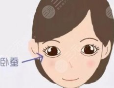 填卧蚕多久恢复？填卧蚕的恢复期更关键！一张表看懂