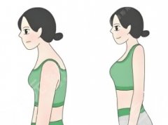 肩胛骨吸脂是哪个部位？别再把“后背厚”当骨架大