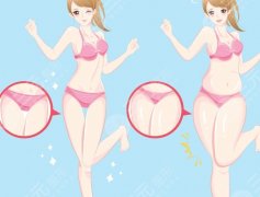 水动力吸脂和手术吸脂有什么区别?谁更适合水动力?谁只能选传统刀? 水动力吸脂和手术吸脂有什么区别?谁更适合水动力?谁只能选传统刀?