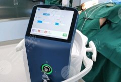 面部黄金微雕多久可以消肿？术后10天实录