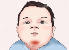 胶原蛋白垫下巴危害，医美小白最容易踩的坑，疼三天，悔三年？