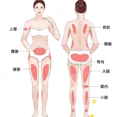 吸脂