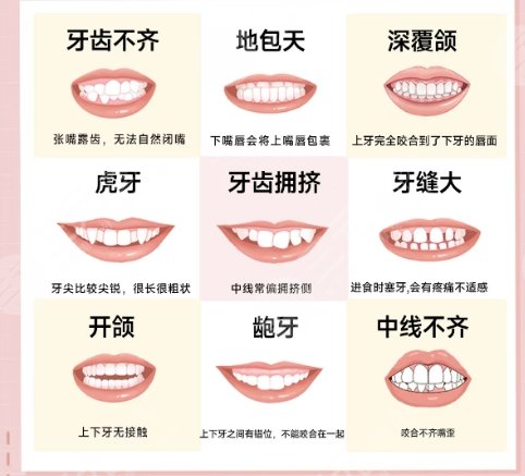 牙齿矫正
