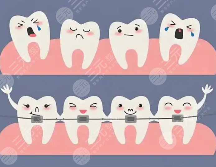 牙齿矫正