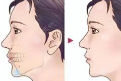 做正畸正颌手术全国医院排名，全国重点医院排名及选择时最该看重的几大指标