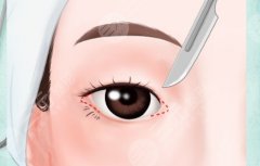 成都眼修复做的好的医生，口碑较好的眼修复医生名单及风格解析