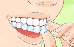 天津牙齿正畸医生推荐，案例、资历、价格全对比，新手如何选对主刀医生？