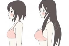 广州隆胸专家排名，多年专注胸部整形的实力医生盘点，附风格与案例特点