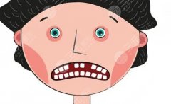 北京健福口腔种植牙怎么样？适合人群、优劣势与常见疑问集中回答