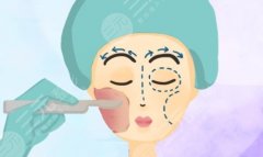 上海轮廓固定医生，从资