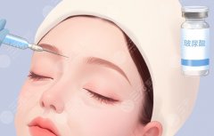 杭州玻尿酸填充去哪个医院？根据预算、部位需求与医生风格选择医院的实用建议